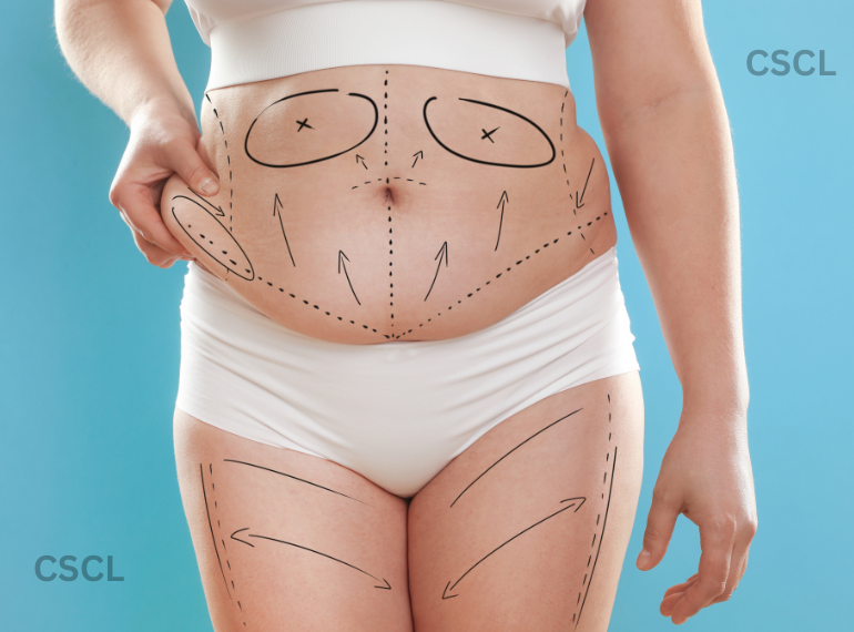 Cosmetic Surgery Centre Ltd (CSCL) – Aesthetic & Plastic Surgery Clinic Overview