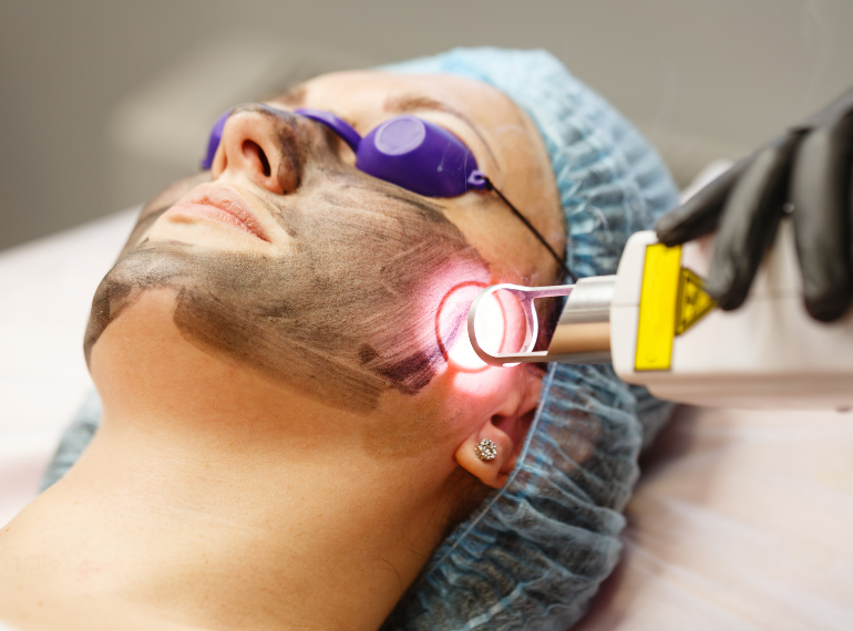 Best Laser Treatment in Dhaka | Hair Removal & Skin Care